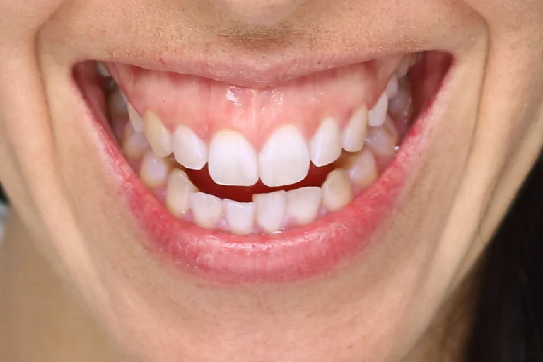 Periodontal Therapy