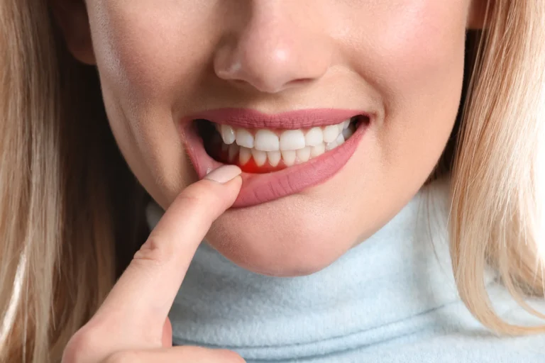 Gum Disease Treatment