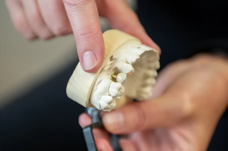 Endodontic Procedures
