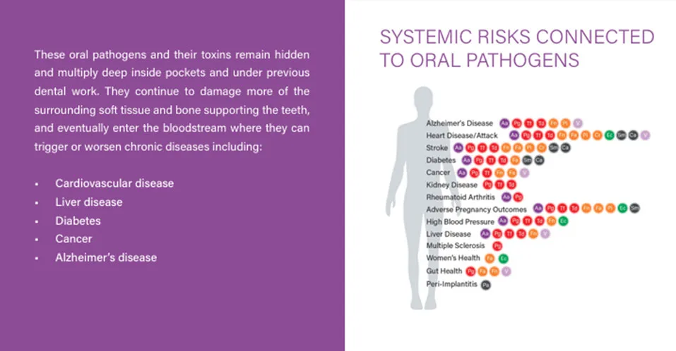Simply Perio Saliva Test
